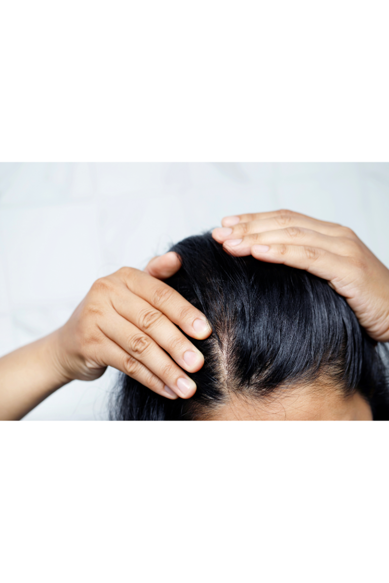 TPM e Cabelo: Entenda a Relação Entre Ciclo Menstrual e a Saúde Capilar